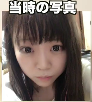 三年食太郎整形前目