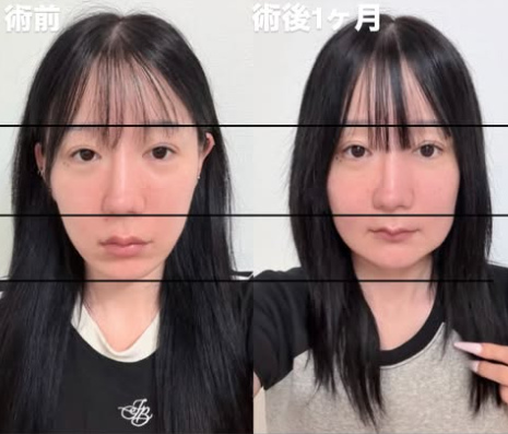 多田さん整形前もかわいい