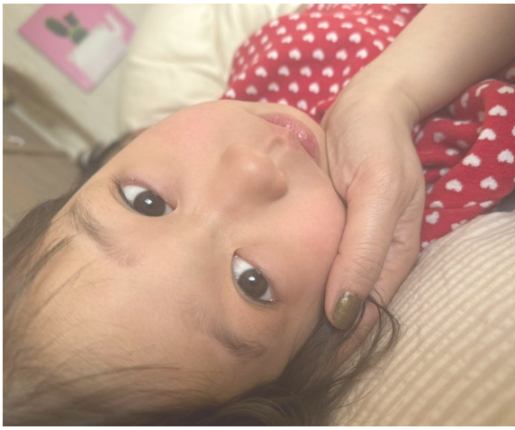 尾形さくら目整形
